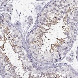 TEX55 Antibody, Novus Biologicals 0.1mL; Unlabeled:Antibodies, Polyclonal