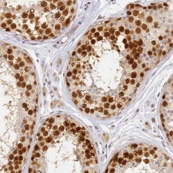 HMCES Antibody, Novus Biologicals 0.1mL; Unlabeled:Antibodies, Polyclonal