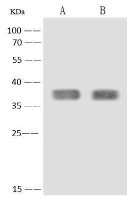 C3orf38 Rabbit anti-Human, Polyclonal, Novus Biologicals 50 &mu;g | Buy Online | Novus Biologicals | Fisher Scientific