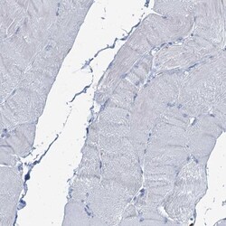 C4.4A/LYPD3 Antibody, Novus Biologicals 25 &mu;L, Unlabeled:Antibodies,
