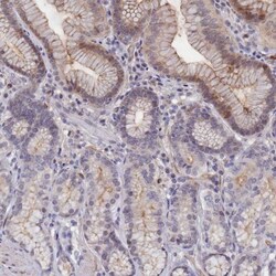 C4orf19 Antibody, Novus Biologicals 0.1mL; Unlabeled:Antibodies, Polyclonal