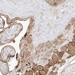 ZGRF1 Antibody, Novus Biologicals 0.1mL; Unlabeled:Antibodies, Polyclonal