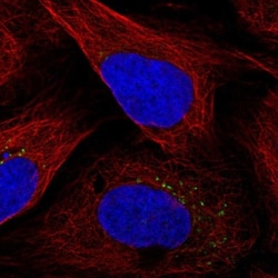 FAM241A Antibody, Novus Biologicals 25 &mu;L | Buy Online | Novus Biologicals | Fisher Scientific