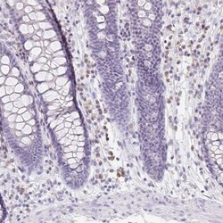 PRR27 Antibody, Novus Biologicals 0.1mL; Unlabeled:Antibodies, Polyclonal