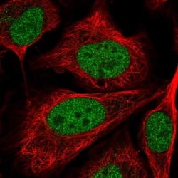 C5orf24 Antibody, Novus Biologicals 25 &mu;L, Unlabeled:Antibodies, Polyclonal