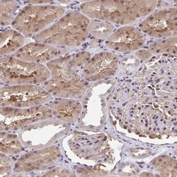 C5orf24 Antibody, Novus Biologicals 25 &mu;L, Unlabeled:Antibodies, Polyclonal