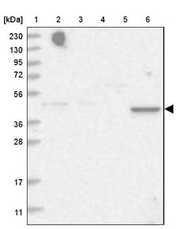 TRAPPC13 Antibody, Novus Biologicals 0.1 mL | Buy Online | Novus Biologicals | Fisher Scientific
