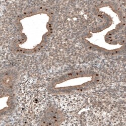 MRN Complex Interacting Protein Antibody, Novus Biologicals 0.1mL; Unlabeled:Antibodies,