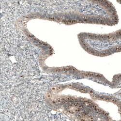 MRN Complex Interacting Protein Antibody, Novus Biologicals 0.1mL; Unlabeled:Antibodies,