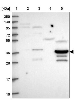 MRN Complex Interacting Protein Antibody, Novus Biologicals 0.1mL; Unlabeled:Antibodies,