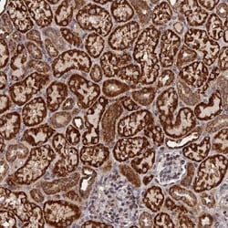 C5orf49 Antibody, Novus Biologicals:Antibodies:Primary Antibodies