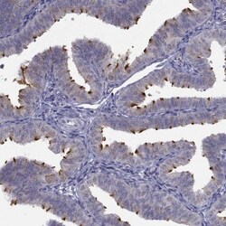 C5orf49 Antibody, Novus Biologicals:Antibodies:Primary Antibodies