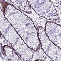 C6orf132 Antibody, Novus Biologicals:Antibodies:Primary Antibodies