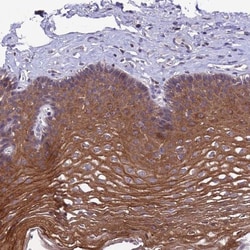 C6orf132 Antibody, Novus Biologicals:Antibodies:Primary Antibodies