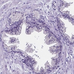 LRRC73 Antibody, Novus Biologicals:Antibodies:Primary Antibodies