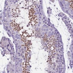 LRRC73 Antibody, Novus Biologicals:Antibodies:Primary Antibodies