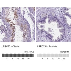 LRRC73 Antibody, Novus Biologicals:Antibodies:Primary Antibodies