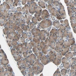 SMIM8 Antibody, Novus Biologicals 0.1mL; Unlabeled:Antibodies, Polyclonal