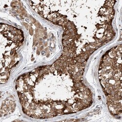 CEP85L Antibody, Novus Biologicals:Antibodies:Primary Antibodies