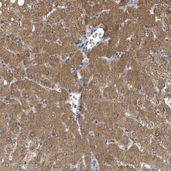 C6orf52 Antibody, Novus Biologicals 25ul | Buy Online | Novus Biologicals | Fisher Scientific