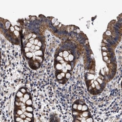 MALSU1 Antibody, Novus Biologicals 0.1mL; Unlabeled:Antibodies, Polyclonal