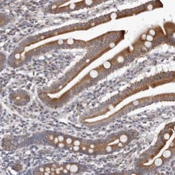MAP11 Antibody, Novus Biologicals:Antibodies:Primary Antibodies