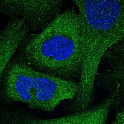 FAM221A Antibody, Novus Biologicals:Antibodies:Primary Antibodies