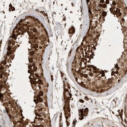 FAM221A Antibody, Novus Biologicals:Antibodies:Primary Antibodies