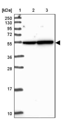 LUC7L2 Antibody, Novus Biologicals 0.1mL; Unlabeled:Antibodies, Polyclonal