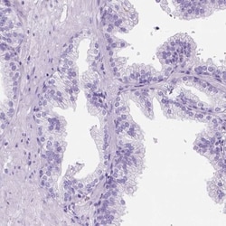 C7orf57 Antibody, Novus Biologicals 0.1mL; Unlabeled:Antibodies, Polyclonal