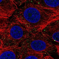 C7orf61 Antibody, Novus Biologicals 0.1mL; Unlabeled:Antibodies, Polyclonal