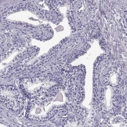 C7orf61 Antibody, Novus Biologicals 0.1mL; Unlabeled:Antibodies, Polyclonal