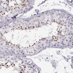 C7orf61 Antibody, Novus Biologicals 0.1mL; Unlabeled:Antibodies, Polyclonal