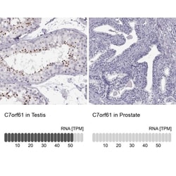 C7orf61 Antibody, Novus Biologicals 0.1mL; Unlabeled:Antibodies, Polyclonal