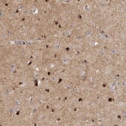 RBM48 Antibody, Novus Biologicals 0.1mL; Unlabeled:Antibodies, Polyclonal