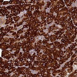 C8orf44 Antibody, Novus Biologicals:Antibodies:Primary Antibodies