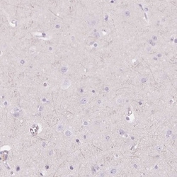 Glutamate Rich 5 Antibody, Novus Biologicals 0.1mL; Unlabeled:Antibodies,