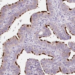 Glutamate Rich 5 Antibody, Novus Biologicals 0.1mL; Unlabeled:Antibodies,