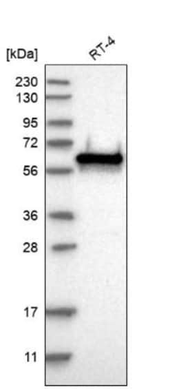 Glutamate Rich 5 Antibody, Novus Biologicals 0.1mL; Unlabeled:Antibodies,