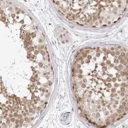 C8orf48 Antibody, Novus Biologicals 0.1mL; Unlabeled:Antibodies, Polyclonal