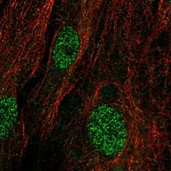 TRMT9B Antibody, Novus Biologicals 25 &mu;L; Unlabeled:Antibodies, Polyclonal