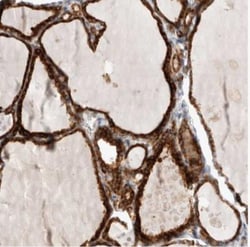 TRMT9B Antibody, Novus Biologicals 25 &mu;L; Unlabeled:Antibodies, Polyclonal