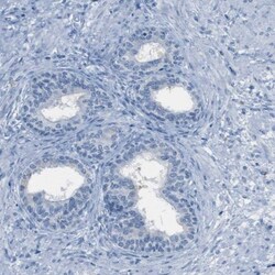 EQTN Antibody, Novus Biologicals 25 &mu;L; Unlabeled:Antibodies, Polyclonal