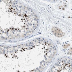 EQTN Antibody, Novus Biologicals 25 &mu;L; Unlabeled:Antibodies, Polyclonal