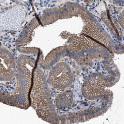 TMEM261 Antibody, Novus Biologicals:Antibodies:Primary Antibodies