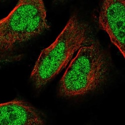 C9orf152 Antibody, Novus Biologicals:Antibodies:Primary Antibodies