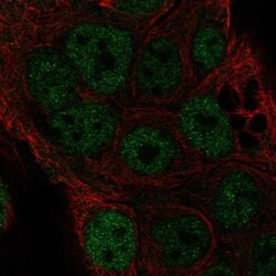 Torsin-4A Antibody, Novus Biologicals:Antibodies:Primary Antibodies