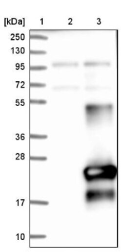 Cysteine Rich Tail 1 Antibody, Novus Biologicals 0.1mL; Unlabeled:Antibodies,
