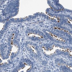 CFAP77 Antibody, Novus Biologicals 25 &mu;L | Buy Online | Novus Biologicals | Fisher Scientific