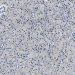 PLGRKT Antibody, Novus Biologicals 0.1mL; Unlabeled:Antibodies, Polyclonal